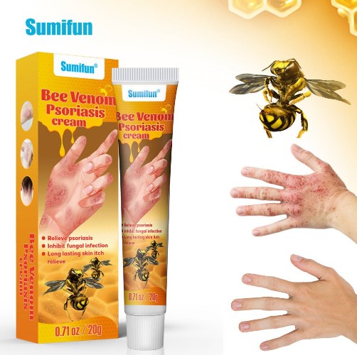 Summifun - Bee Venom Psoriasis Cream