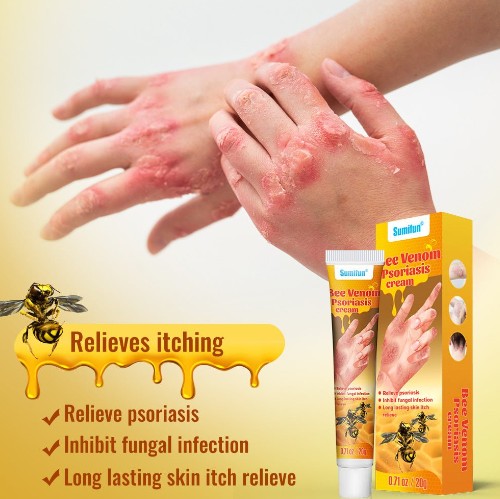 Summifun - Bee Venom Psoriasis Cream
